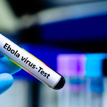 İsrail'de ilk kez Ebola şüphesiyle bir kişi karantinaya alındı