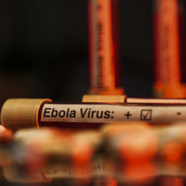 Ölümcül Ebola Avrupa’ya sıçradı!