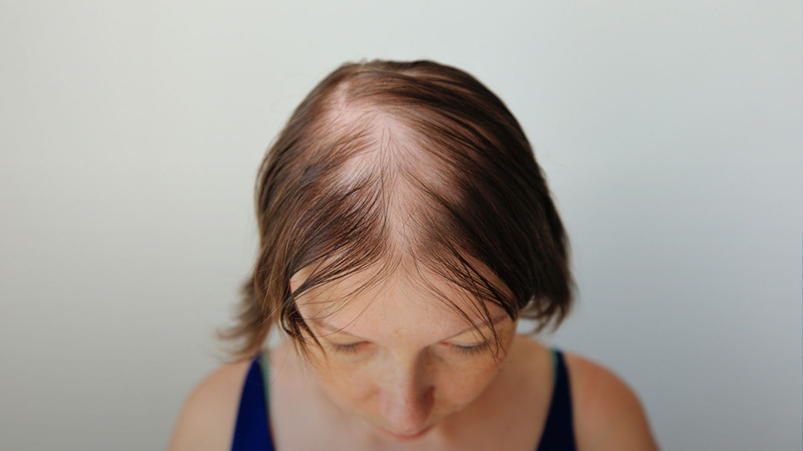 Dökülen saçlara dikkat!