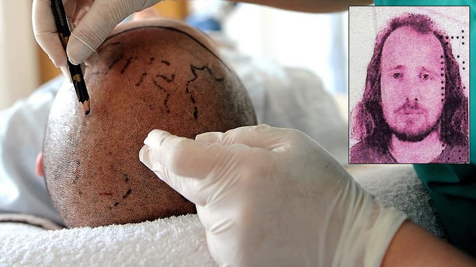 Saç ekimi ve diş tedavisi için Türkiye'ye gelen İngiliz vatandaşı öldü