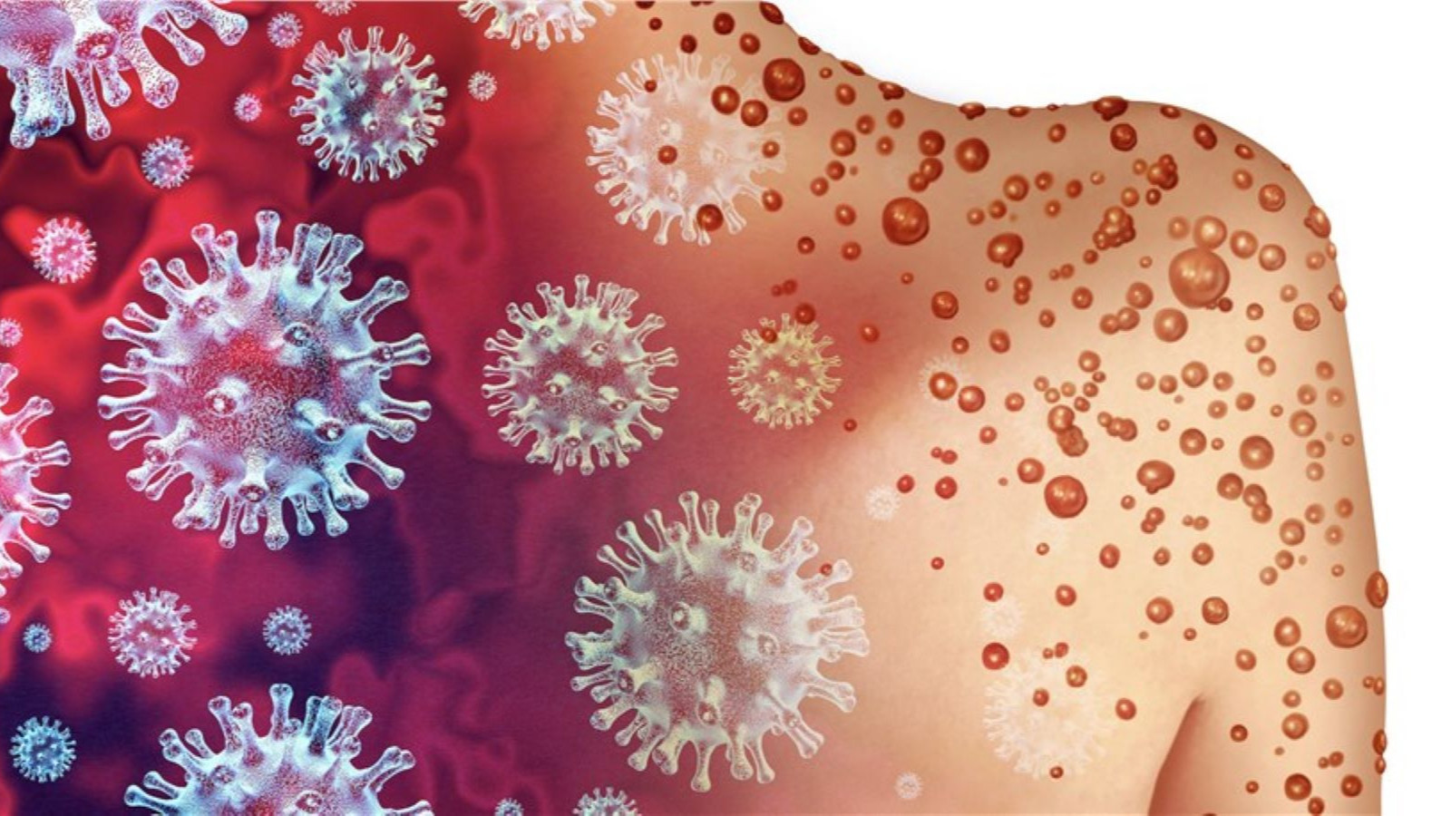 Maymun çiçeği virüsünün en tehlikeli varyantı İspanya'da tespit edildi