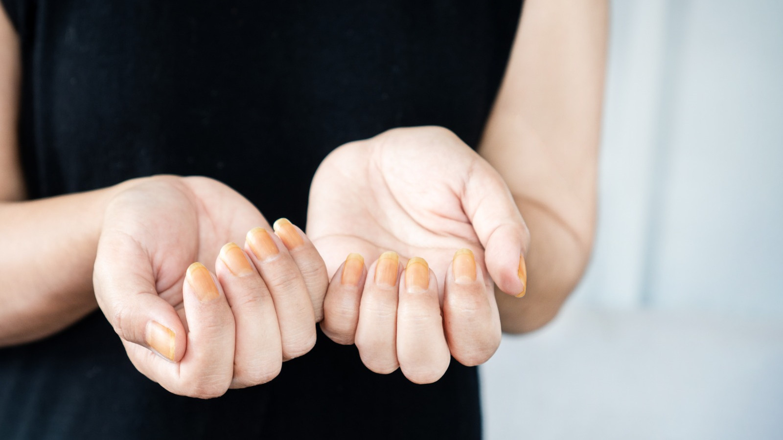 Sararan tırnakları anında beyazlatan doğal yöntem buymuş