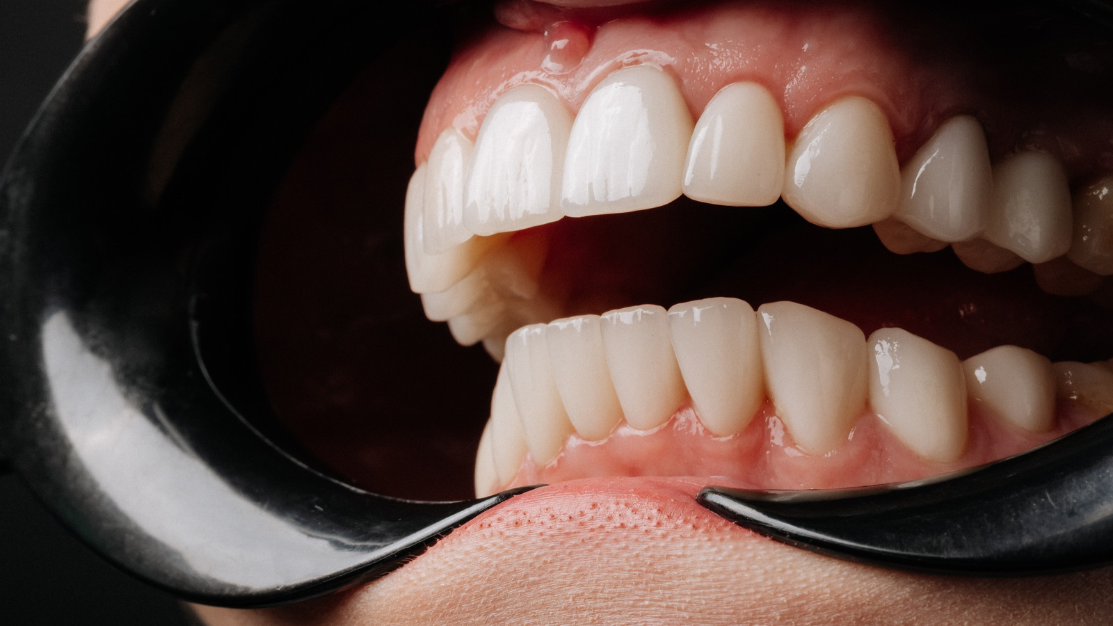 Dişlerinizin durumu erken ölüm riskinin habercisi olabilir