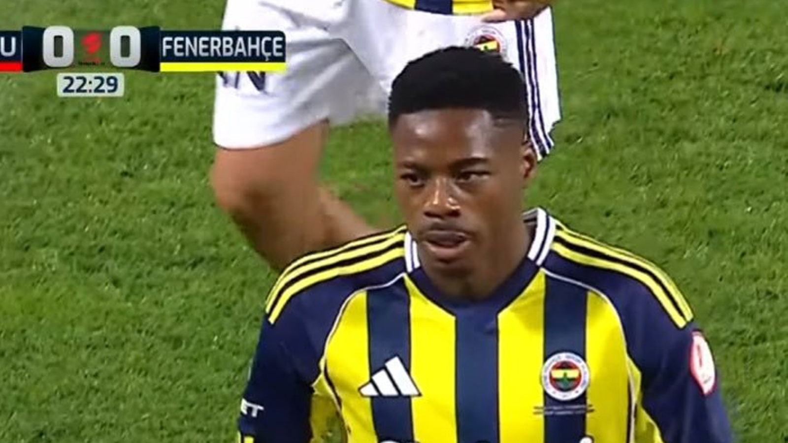 Fenerbahçe'de yeni transfer Musaba sakatlandı