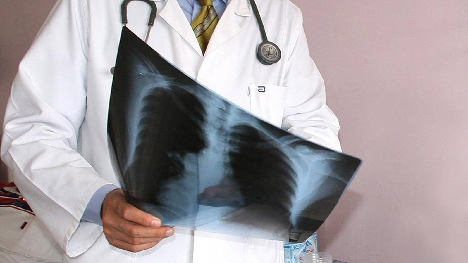 Soğuk havalarda zatürreye dikkat: Erken müdahale önemli