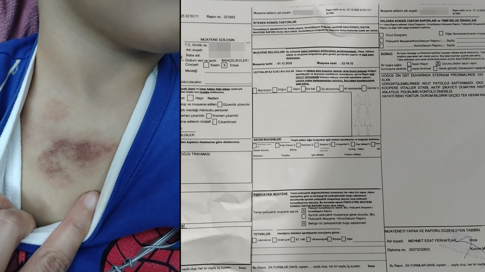 İBB kreşinde istismar ve darp skandalı! Çocukları tacize uğrayan aile şikayetçi oldu