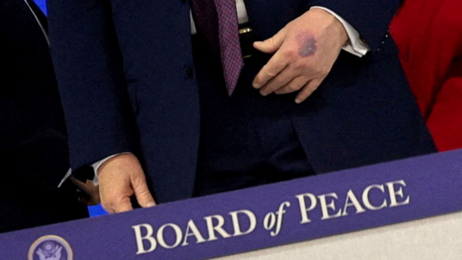 Trump'ın elindeki morluk kameralarca görüntülendi