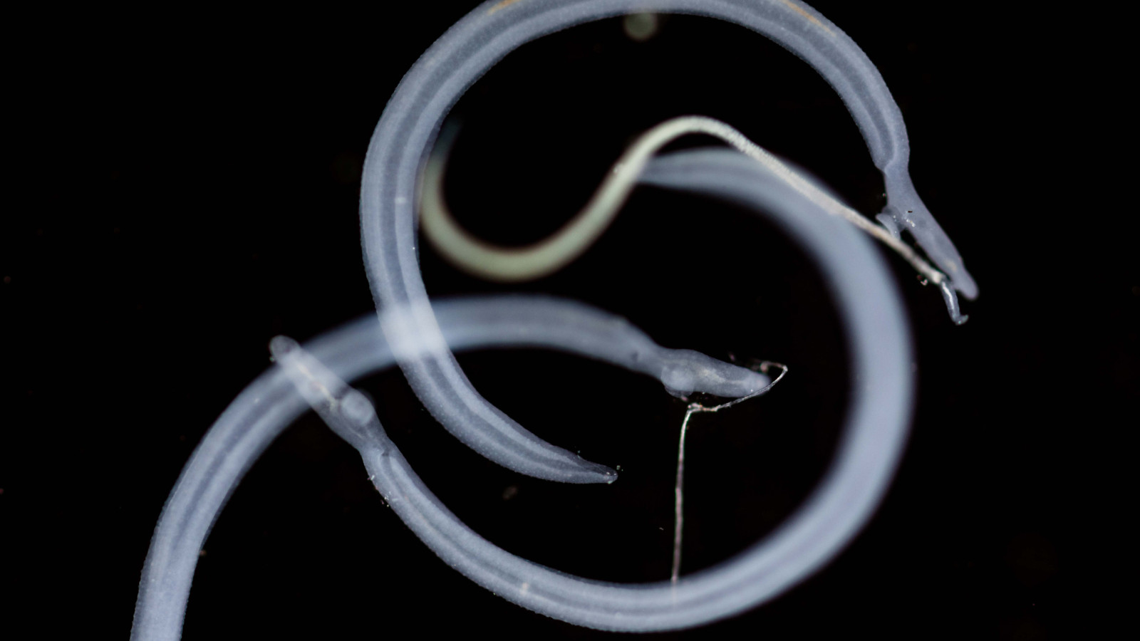 78 ülkede tespit edildi! Kontrolden çıkabilir: Cinsel organlara yerleşip...