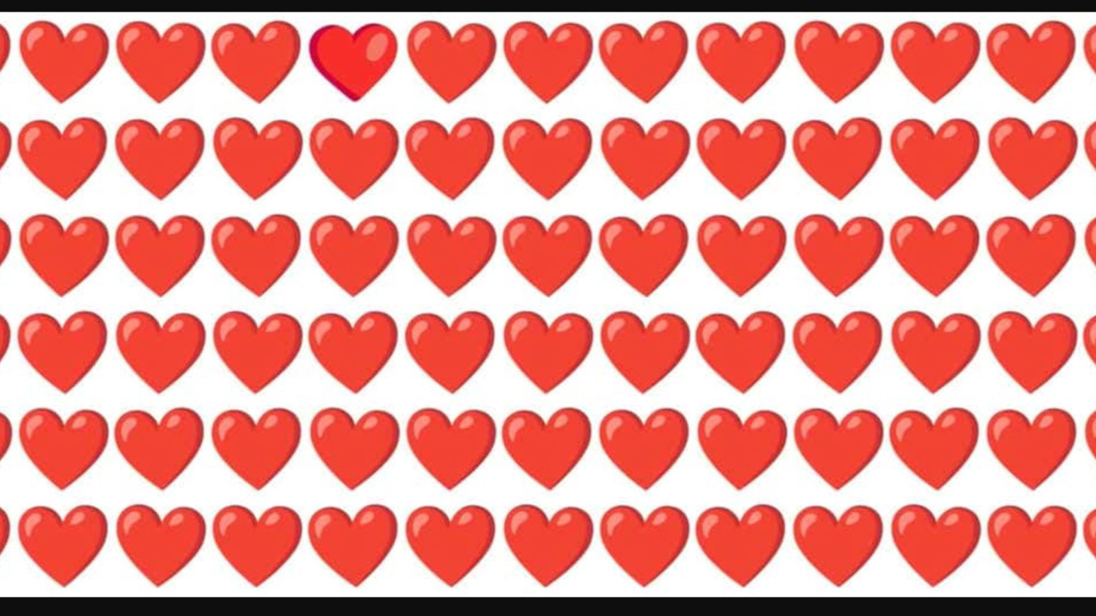 Resimdeki farklı kalbi doktorlar bile bulamıyor!