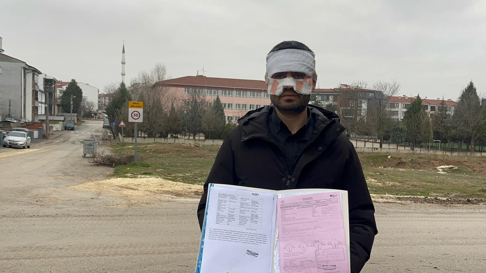 Rehber öğretmenin yüzüne sıcak çay fırlattığı fizik öğretmeni feci şekilde yandı