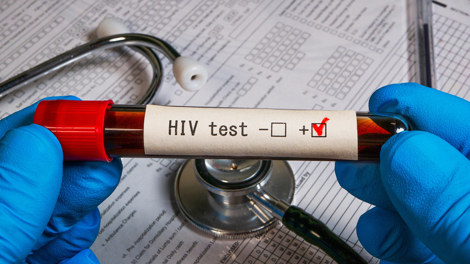 Evlenmeden önce HIV pozitif olduğunu sakladı: Karar belli oldu