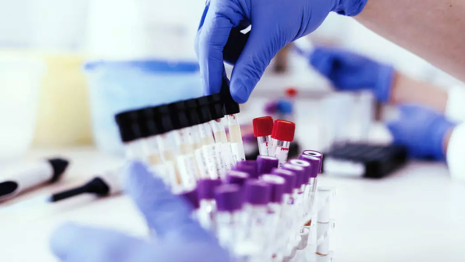 Uyuşturucu operasyonları sonrası şirketler harekete geçti! 20 binden fazla şirket işe alımlarda madde testi istemeye başladı.