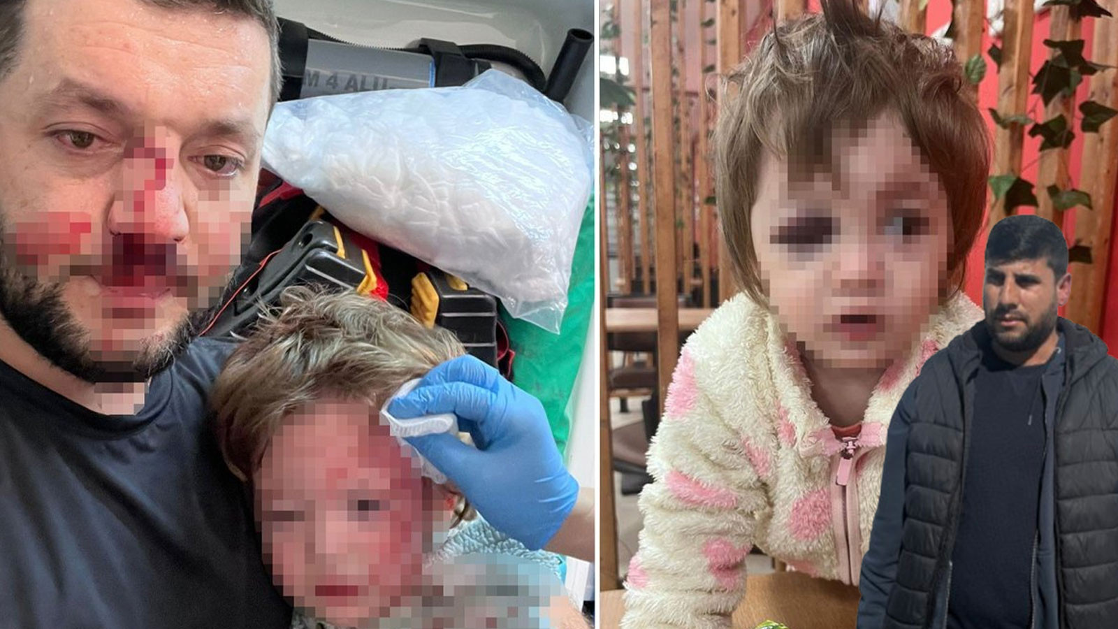 14 aylık İkra bebek hastanelik olmuştu! Saldırgan komşu kendini savundu: "Çocuk annesinin kucağından düştü"