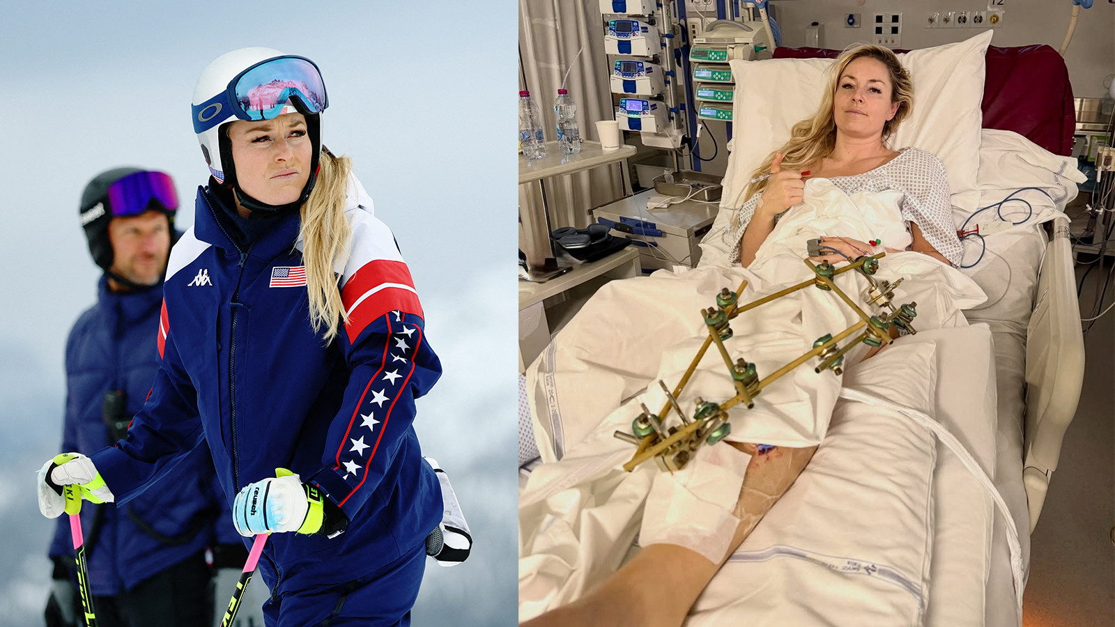 Lindsey Vonn'un bacağı son anda kurtarıldı! Ronaldo'dan destek mesajı