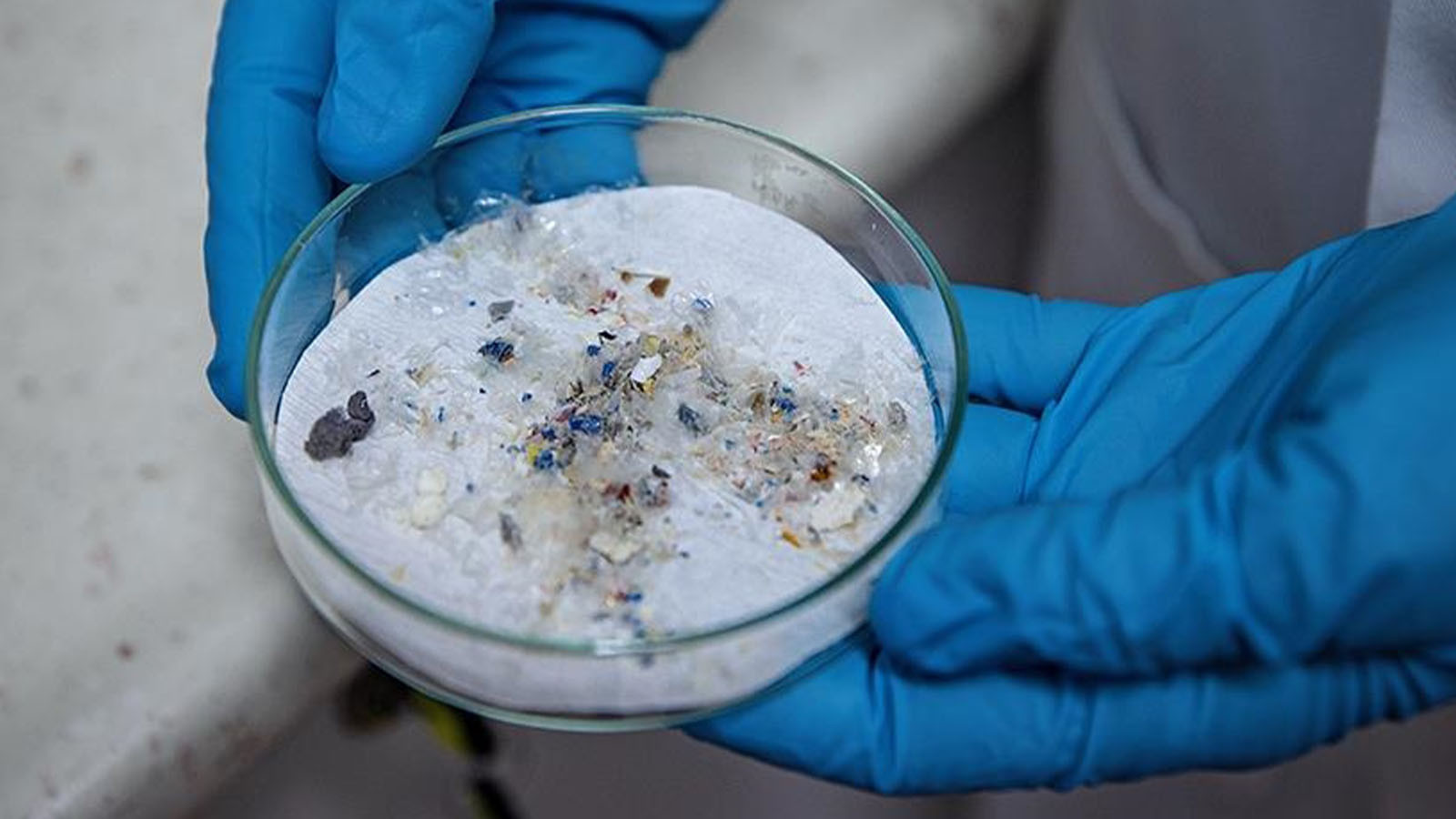 Ürpertici gıda raporu! Bir porsiyonda  500 bin zehir