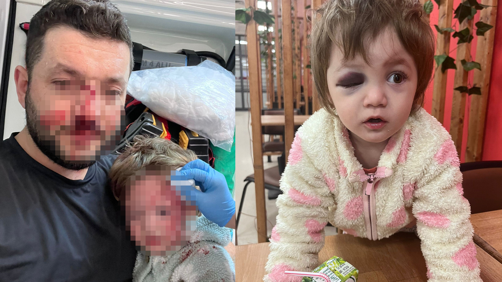 Yalova'da 14 aylık bebeği saldırı: Skuter silah sayıldı, 36 yıl hapis istendi