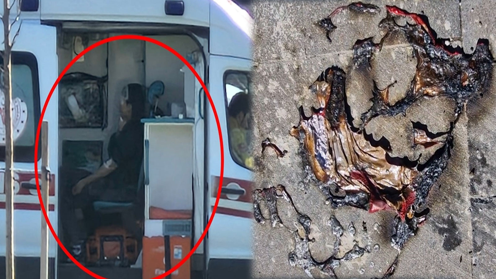 Oynadıkları helyum gazı dolu balonlar patladı: 2 yaralı