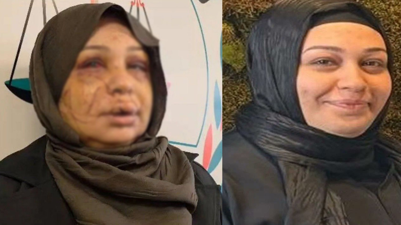 Eşini, yüzünü keserek tanınmaz hale getirmişti... Polis memurunun davası ağır cezada görülecek