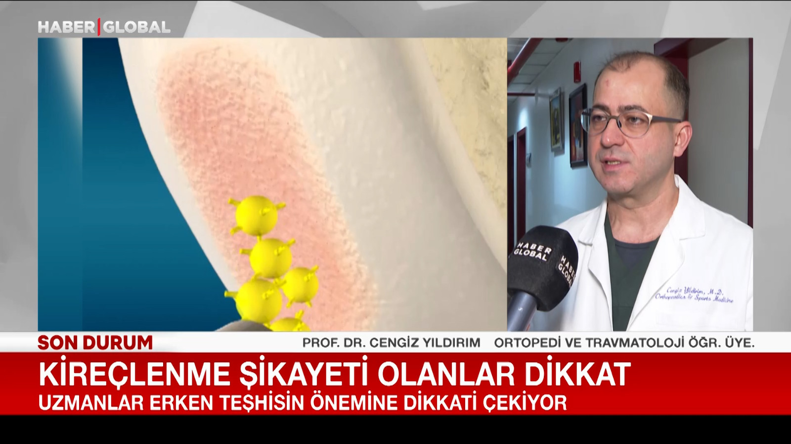 Kireçlenme şikayeti olanlar dikkat!