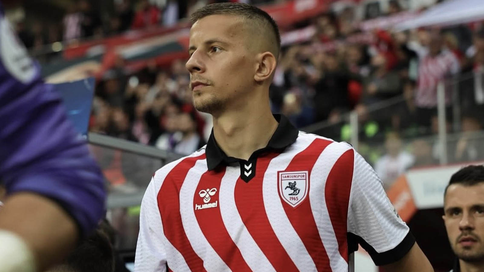 Samsunsporlu Satka’nın elinde kırık tespit edildi