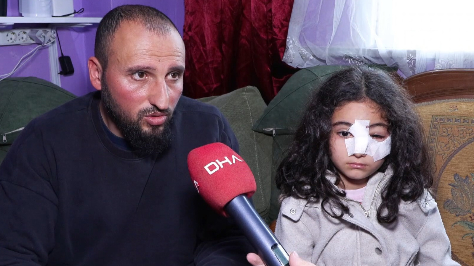 Eyüpsultan'da sokak köpeği dehşeti: Okuldan eve dönen küçük kız yüzünden yaralandı