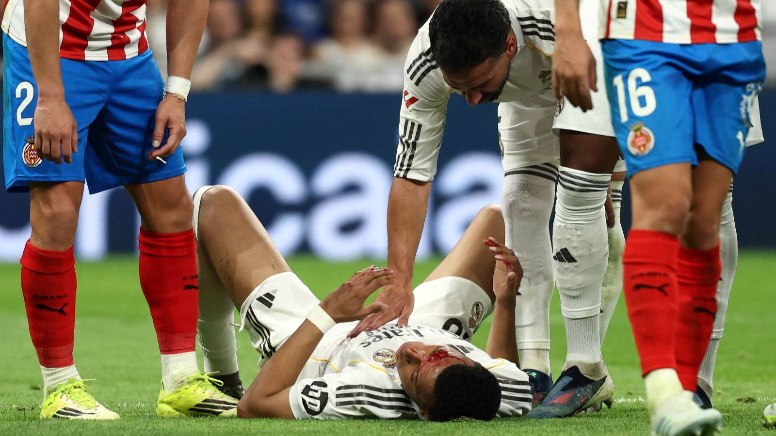 Mbappe'nin kanlar içindeki görüntüsü neden gösterilmedi?