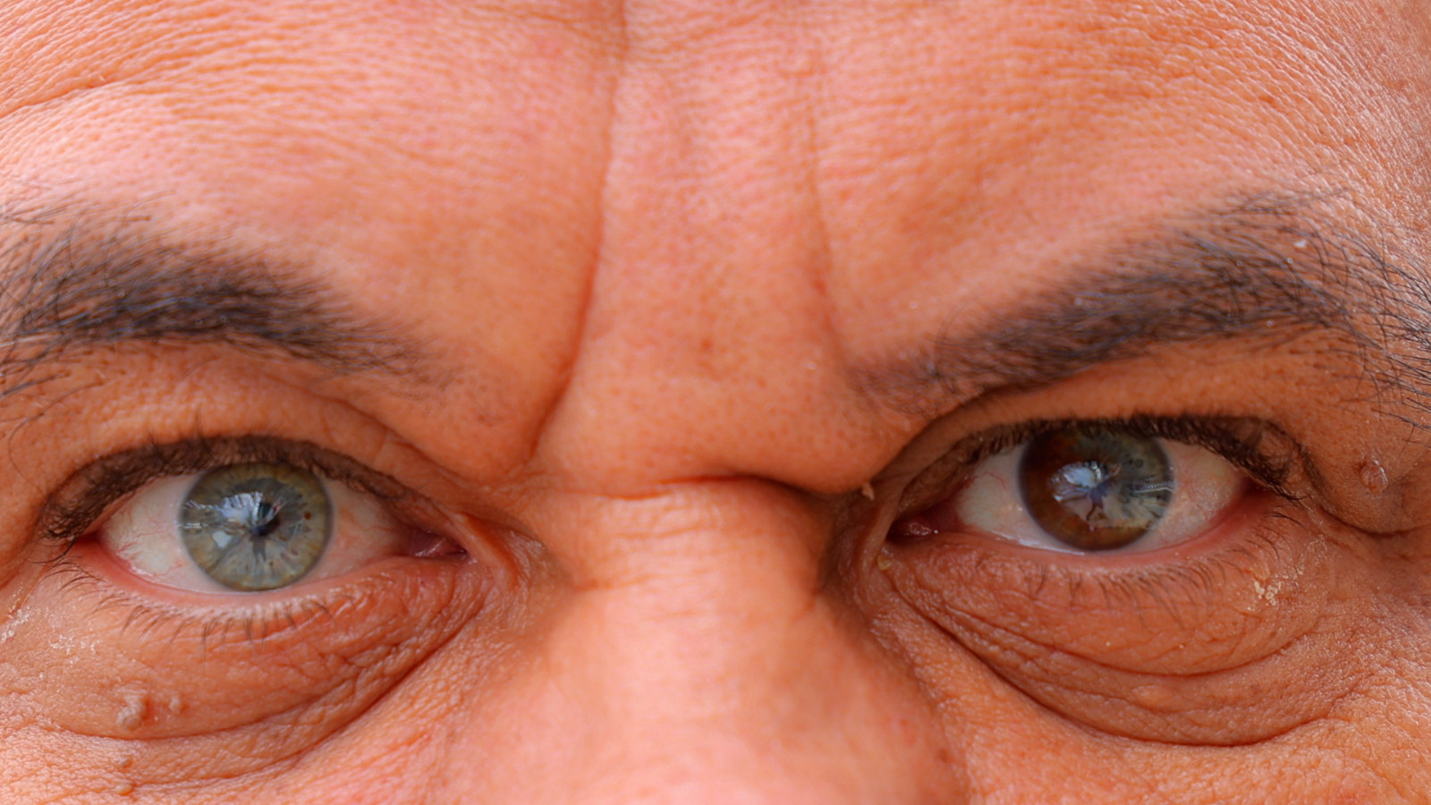 Kahramanmaraşlı adam 3 renkli gözleriyle görenleri şaşırtıyor