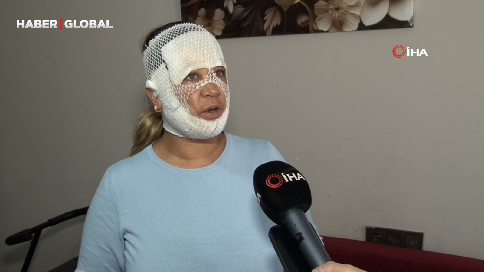 Güzelleşmek için gittiği merkezde yüzü böyle yandı