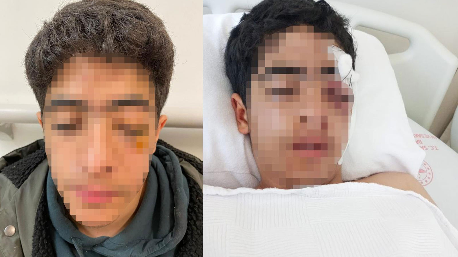 Esenyurt'ta akran zorbalığı! 15 yaşındaki çocuğa muştalı saldırı