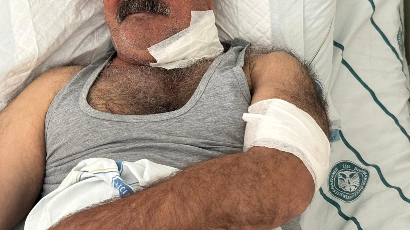 At tarafından ısırılan kişi ağır yaralandı