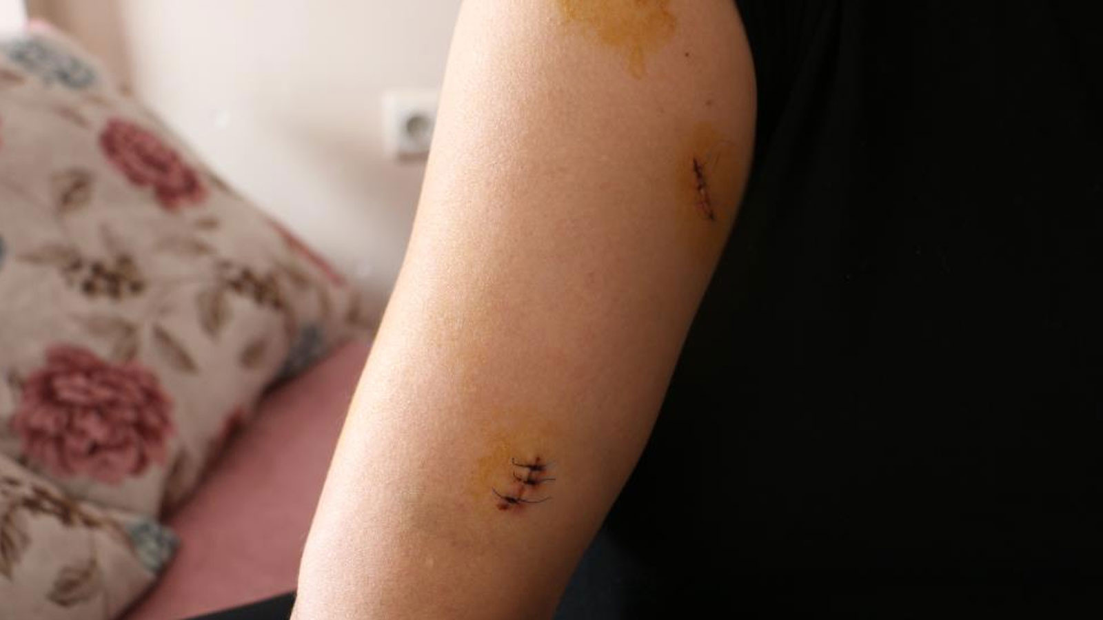 Diyarbakır’da dehşet! Dini nikahlı eşini 30 yerinden bıçakladı