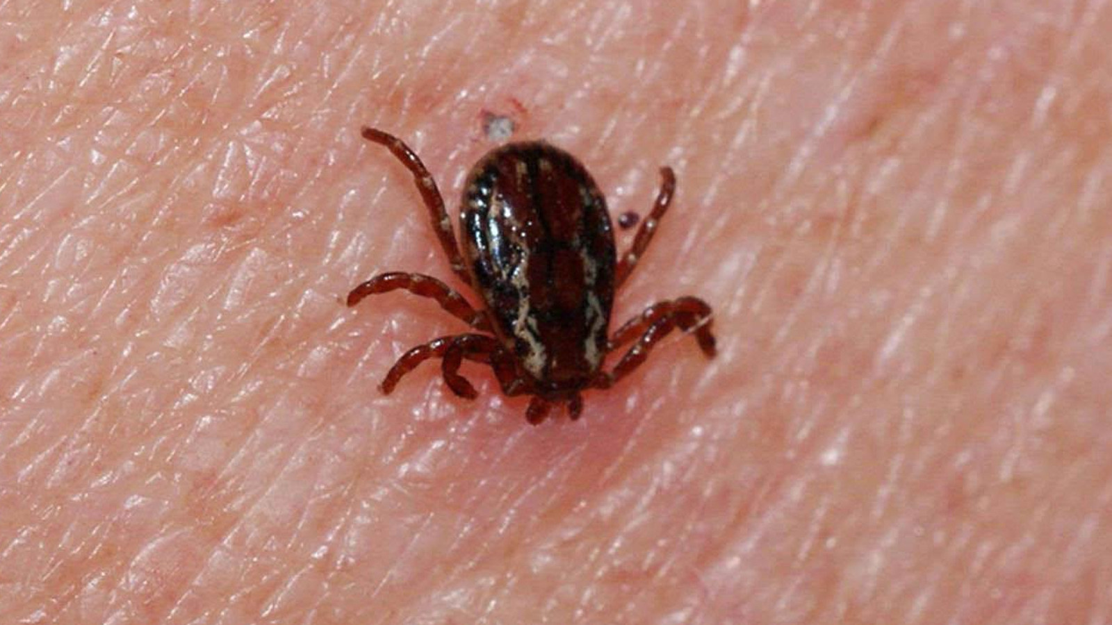 Kene kabusu geri döndü! Sivas'ta bir genç hayatını kaybetti