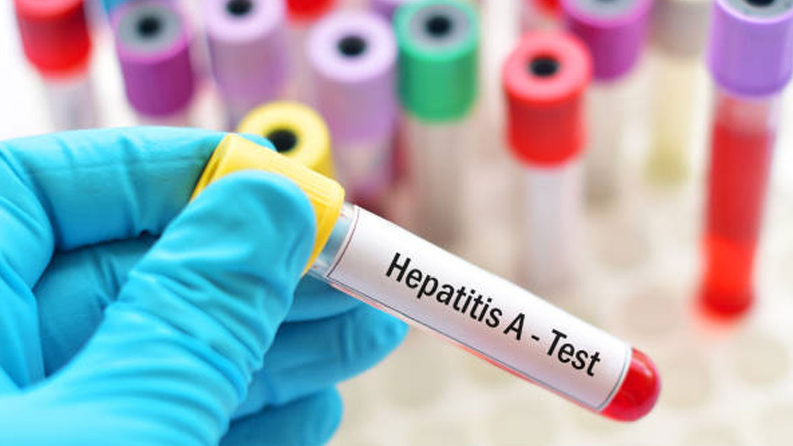 Sağlık Bakanlığı duyurdu! Hepatit A aşısı ilk kez Türkiye'de üretildi! 81 ilde kullanıma sunuldu