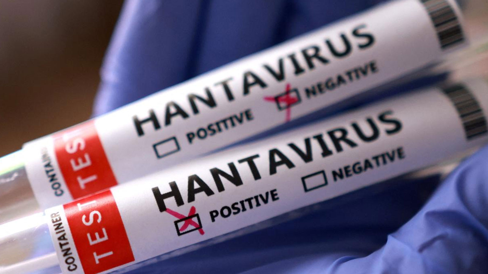 Hantavirüs dünyaya yayılıyor! Durdurulamayan ölümcül virüsle ilgili son gelişmeler!