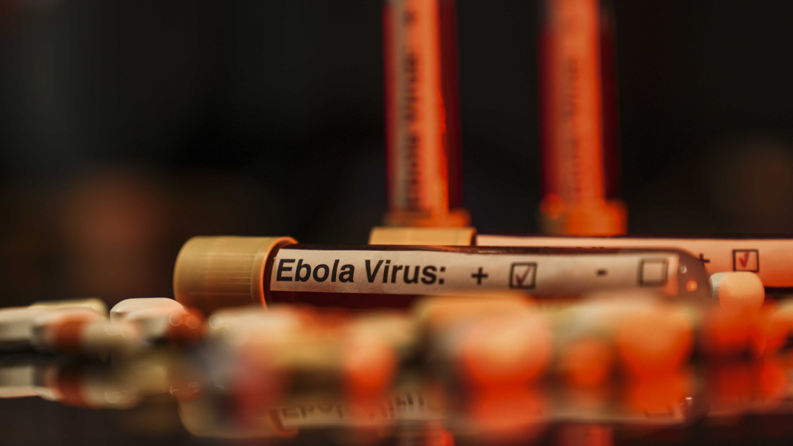 Ölümcül Ebola Avrupa’ya sıçradı!