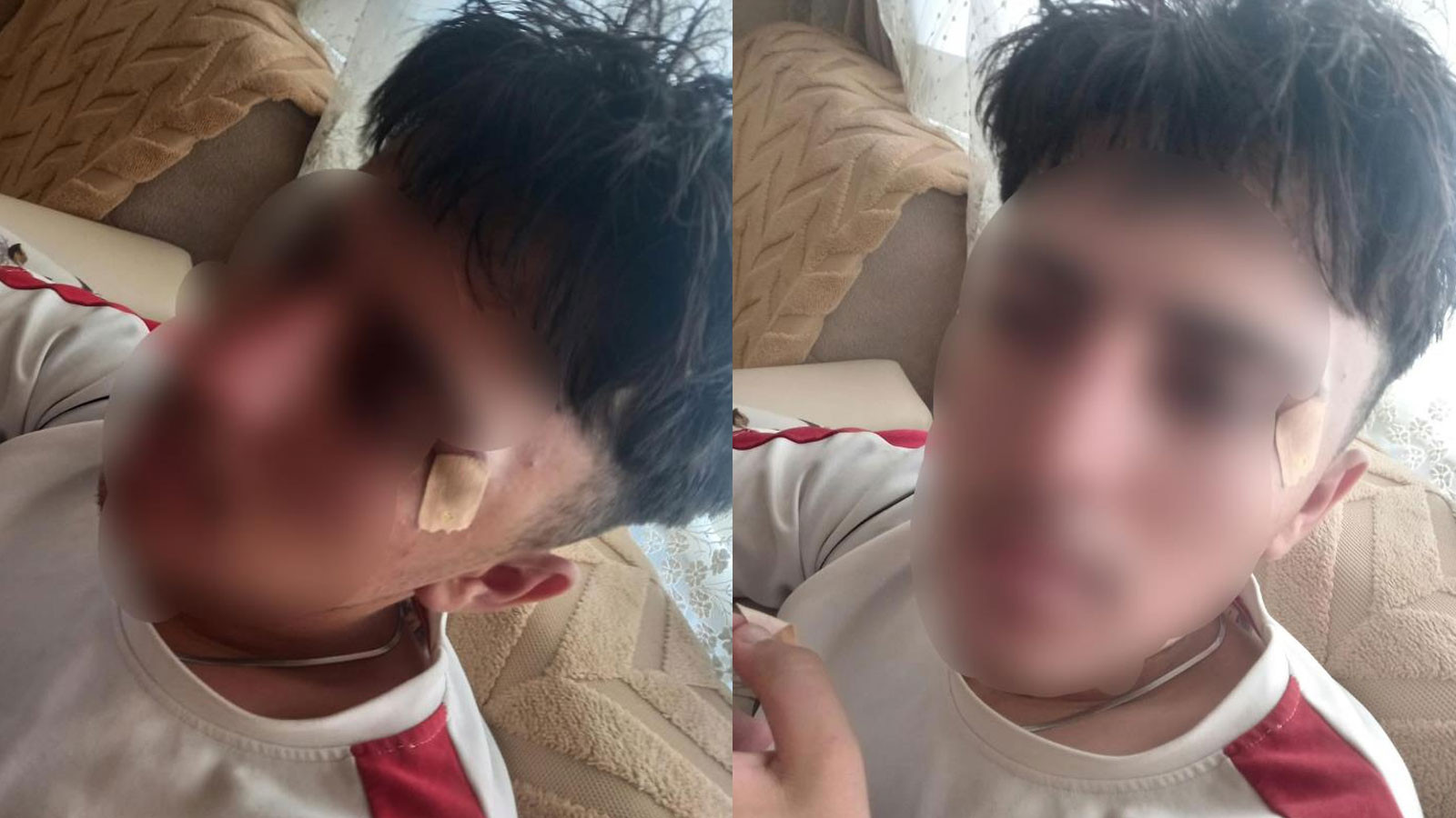 Afyonkarahisar’da öğretmenin kafa attığı çocuğun burnu kırıldı: Soruşturma başlatıldı
